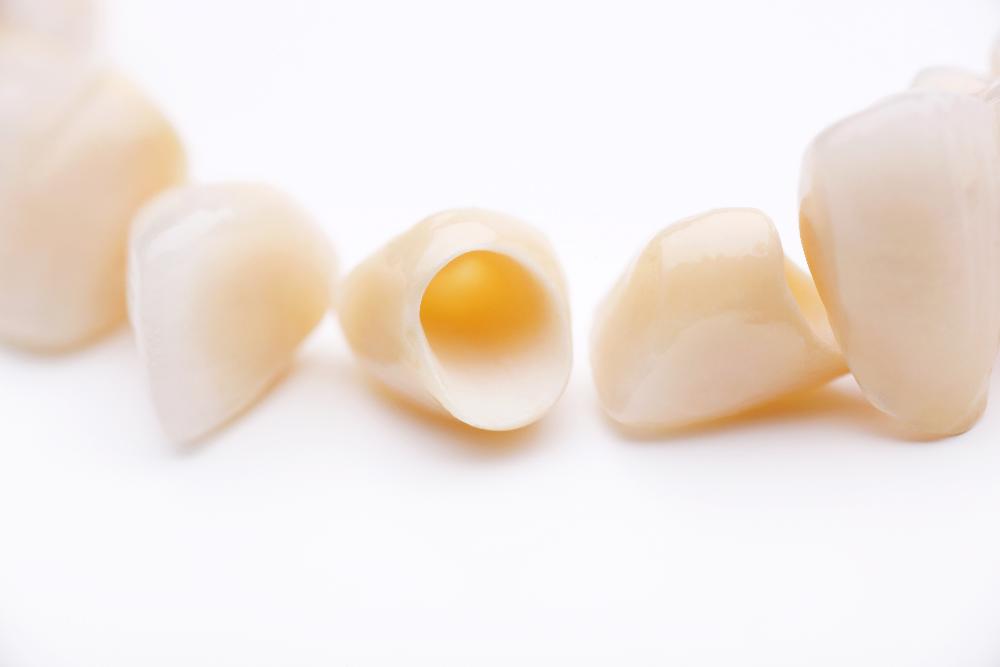 Close up of dental crowns in Chico CA | 95928 Dentist